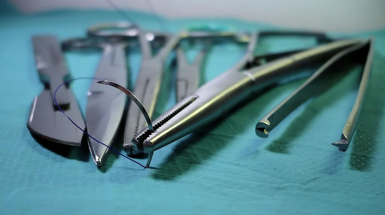 surgery, tools, scalpel, scissors, tweezers, vice, needle holder, hegar, paean, needle, operation, procedure, patient, the doctor, medical, hospital, steel, surgery, surgery, surgery, surgery, surgery. Facial fat transfer swelling: peak days and recovery time in the US