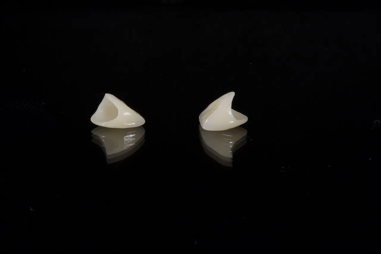 dental, porcelain tooth, wax, dental, dental, dental, dental, dental. Veneers: a researched style guide for 2027, in plain terms