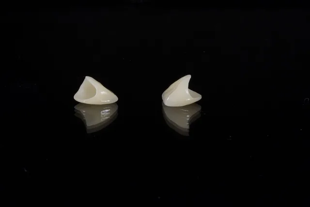 dental, porcelain tooth, wax, dental, dental, dental, dental, dental. Veneers: a researched style guide for 2027, in plain terms
