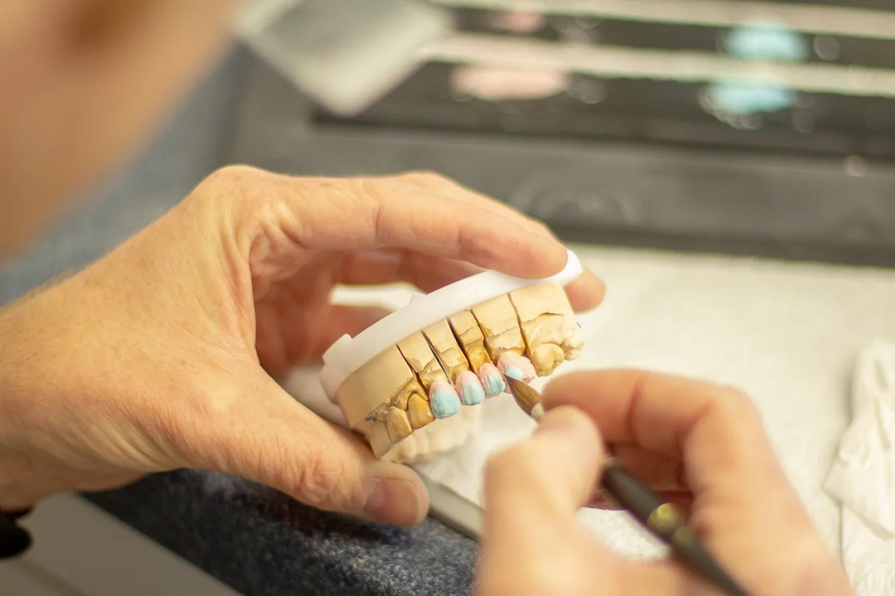 tooth replacement, dentist, healthcare, dentistry, smile, ceramic, applying, hand labor, person, clinic, equipment, brown smile, brown healthcare, dentist, dentist, dentistry, dentistry, dentistry, dentistry, dentistry. Veneers checklist for before-and-after ad photos