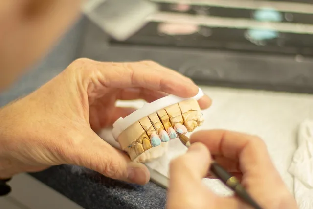 tooth replacement, dentist, healthcare, dentistry, smile, ceramic, applying, hand labor, person, clinic, equipment, brown smile, brown healthcare, dentist, dentist, dentistry, dentistry, dentistry, dentistry, dentistry. Veneers checklist for before-and-after ad photos